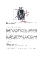 신경계 질환별 물리치료 - 복합성 부위 통증증후군[CRPS; Complex Regional Pain Syndrome]-4