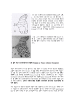 통증의학 - 중추신경계에서의 통증 경로[Pain Pathway in the Central Nervous System]-5
