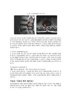 추간판 탈출증의 진단과 치료에 대한 조사-5