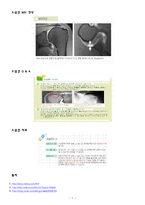 [재활의학] Frozen Shoulder[동결견; 오십견]-7