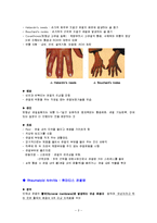 [의학] Osteoarthritis와 Rheumatoid Arthritis의 차이와 치료-2