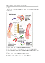 [의학] 복합부위 통증 증후군[CRPS ; Complex Regional Pain Syndrome]에 대해서-3