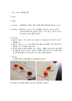 일반생물학 - ABO식 혈액형 판별-1