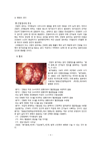 [성인간호학][HCC][간암][간세포암] 케이스 스터디(Case Study), 문헌고찰(hepatocellular carcinoma)-6