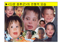 [특수교육] 정신지체의 생물학적 원인, 정신지체의 다양한 원인, 질병등-15