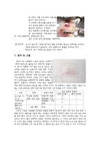 재료공학실습 - 액체 침투 탐상 검사(Liquid Penetrant Testing)-4