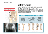 골절환자 간호과정 PBL-8
