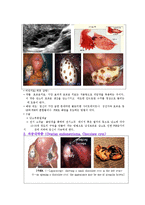 간호학 케이스 스터디 - 난소종양(ovarian tumors)-7