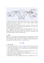 간호학 케이스 스터디 - 난소종양(ovarian tumors)-13