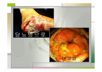 비만(비만교실, 비만이란, 비만의 문제, 표준체중) 발표, PPT, 파워포인트-13