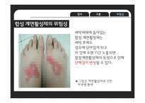 세탁세제의 유해성 논란-9