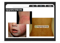세탁세제의 유해성 논란-13