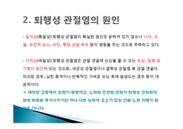 [현대인과 성인병] 퇴행성 관절염의 원인 및 증상과 치료-4