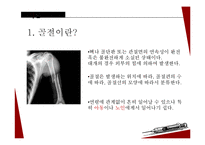 아동 골절의 종류와 응급처치 및 예방법-4