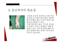 아동 골절의 종류와 응급처치 및 예방법-6