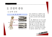 아동 골절의 종류와 응급처치 및 예방법-13