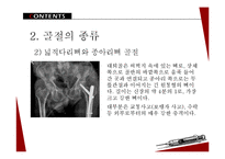 아동 골절의 종류와 응급처치 및 예방법-14