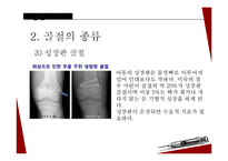 아동 골절의 종류와 응급처치 및 예방법-15
