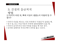 아동 골절의 종류와 응급처치 및 예방법-17
