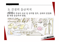 아동 골절의 종류와 응급처치 및 예방법-20