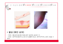 아동 외상사고 현황과 예방법 및 대처법-7