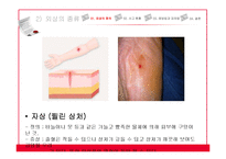 아동 외상사고 현황과 예방법 및 대처법-9