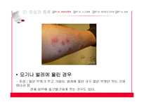 아동 외상사고 현황과 예방법 및 대처법-13
