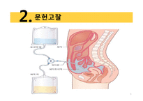 복막투석 환자 간호 진단-9