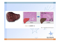 간, 담낭 및 췌장 질환(임상영양학, 간질환, 담도계질환, 췌장질환) PPT, 파워포인트-18