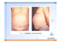 간, 담낭 및 췌장 질환(임상영양학, 간질환, 담도계질환, 췌장질환) PPT, 파워포인트-20