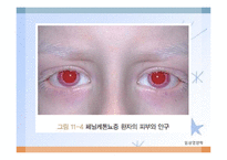 내분비 및 선천성 대사장애 질환(임상영양학, 내분비질환, 선천성대사장애) PPT, 파워포인트-18