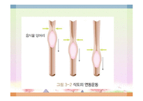 소화기 질환(임상영양학, 구강및식도질환, 위장질환, 장질환) PPT, 파워포인트-4