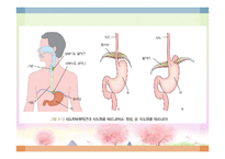 소화기 질환(임상영양학, 구강및식도질환, 위장질환, 장질환) PPT, 파워포인트-6