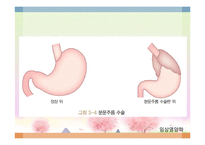 소화기 질환(임상영양학, 구강및식도질환, 위장질환, 장질환) PPT, 파워포인트-9