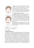 정신지체 아동 사례-3