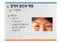 장애의 원인과 예방-7