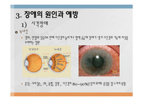 장애의 원인과 예방-8
