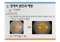 장애의 원인과 예방-12
