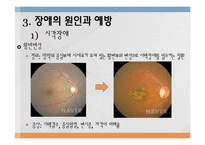 장애의 원인과 예방-18