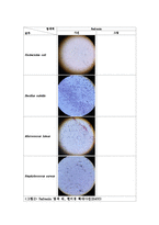 미생물학 실험 - Simple staining(단순염색), Gram staining(그람염색) 실험-6