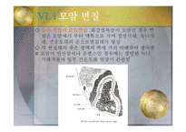 지구환경 과학 - 우리나라의 동광상-13
