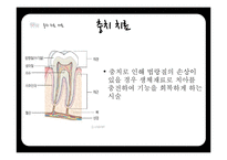 연령별 치과 치료와 치과용 재료-6