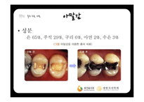 연령별 치과 치료와 치과용 재료-8