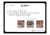 연령별 치과 치료와 치과용 재료-13