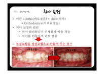 연령별 치과 치료와 치과용 재료-16