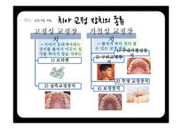 연령별 치과 치료와 치과용 재료-17