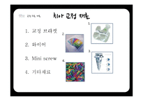 연령별 치과 치료와 치과용 재료-18