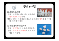 연령별 치과 치료와 치과용 재료-20