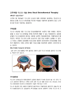 [의학] 고주파열 디스크 시술(Intra Discal Electrothermical Theraphy)-1