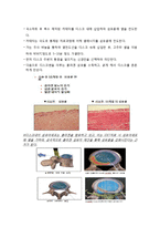 [의학] 고주파열 디스크 시술(Intra Discal Electrothermical Theraphy)-3